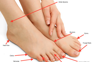 10 Common Foot Problems and Effective Treatment Methods for Relief