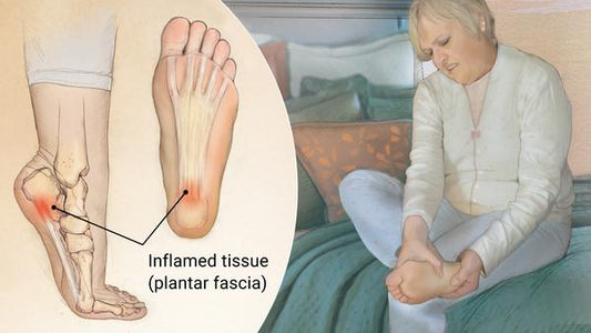 Plantar Fasciitis: Your Comprehensive Guide to Understanding and Managing Heel Pain