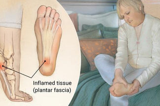 Plantar Fasciitis: Your Comprehensive Guide to Understanding and Managing Heel Pain